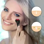 2mm titanium derma roller for acne scars and hair regrowth - obeepo.in
