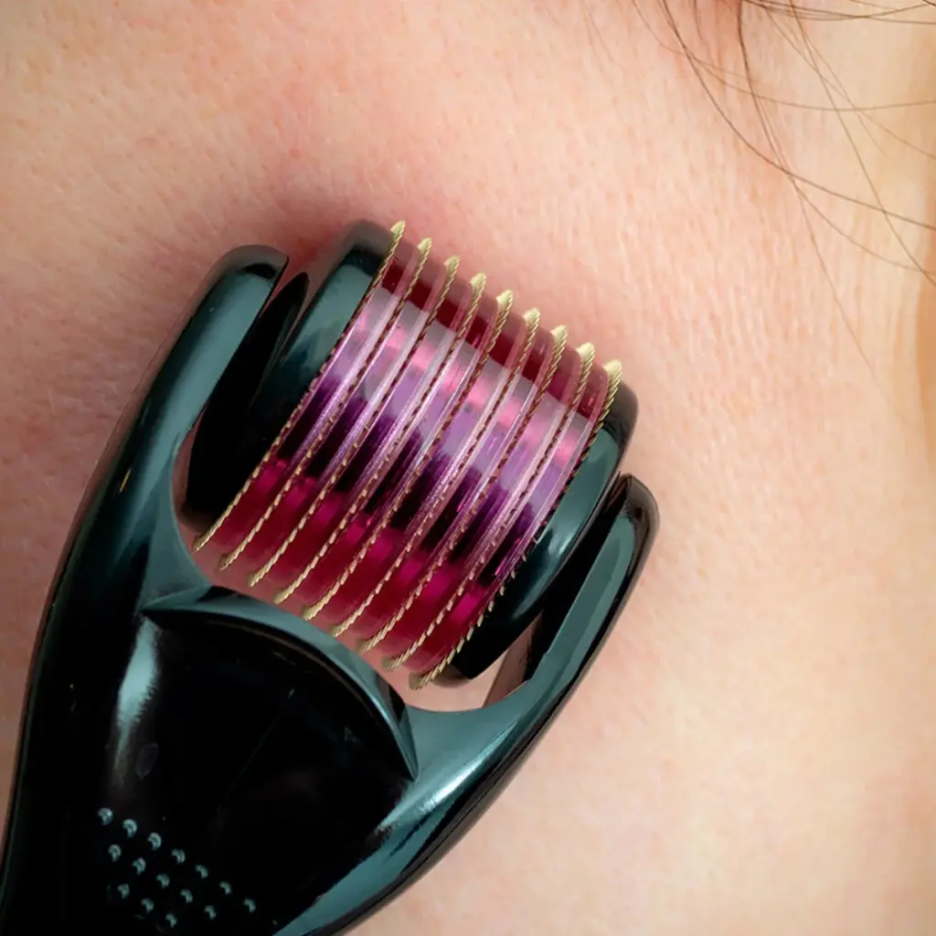 2mm titanium derma roller for acne scars and hair regrowth - obeepo.in