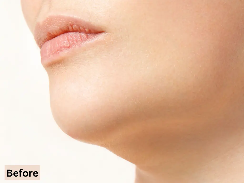 Aura EMS Light Therapy Face Massager – Befre and after - obeepo.in